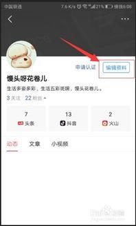 头条为什么名字不能改