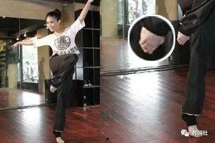 明星大拇指外翻